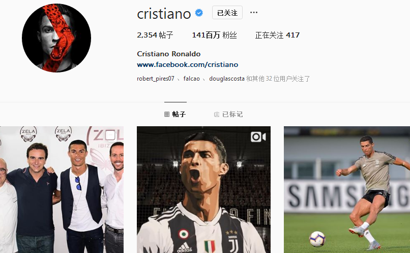 勇记：追梦完成核磁共振检查，后续根据治疗效果观察伤势反应